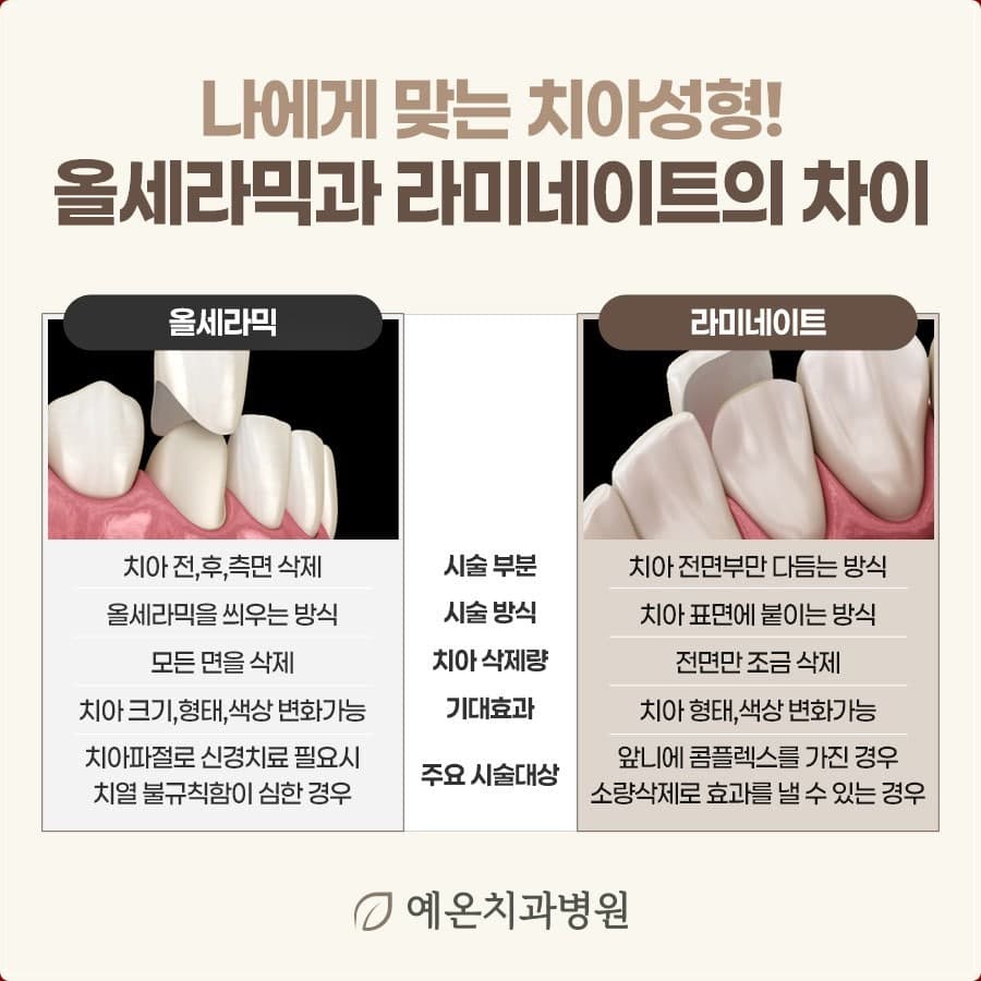 “나에게 맞는 치아성형! 올세라믹과 라미네이트의 차이” 제목 아래 두 시술을 시술 부분·시술 방식·치아 삭제량·기대효과·주요 시술대상으로 비교한 예온치과병원 안내 표